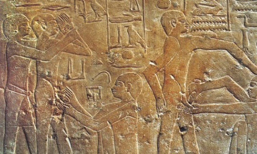History of Circumcision